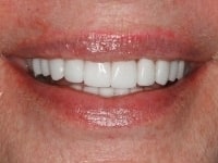 Konig Center for Cosmetic & Comprehensive Dentistry smile photos